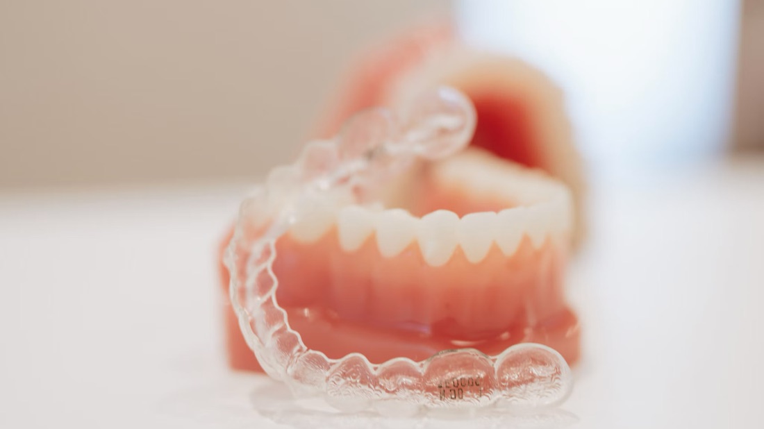 Durchsichtige Aligner-Schiene vor einem Zahnmodell